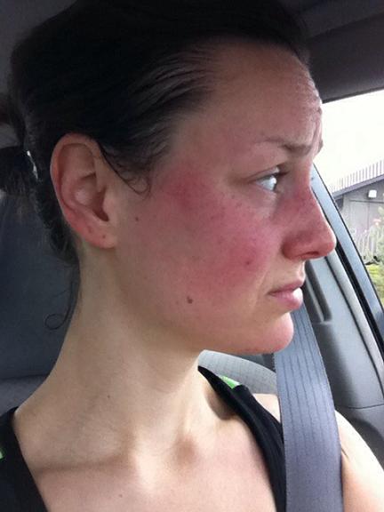 No...that's not a bald spot. My hair is so full of sweat it's matted itself together exposing my scalp. 